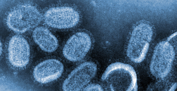 Grippeviren (Foto: CDC)