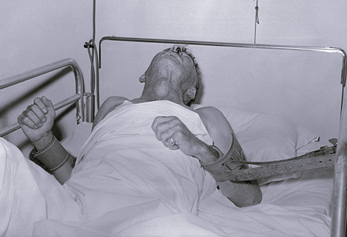 Homme  atteint par la rage attaché dans son lit d'hôpital
